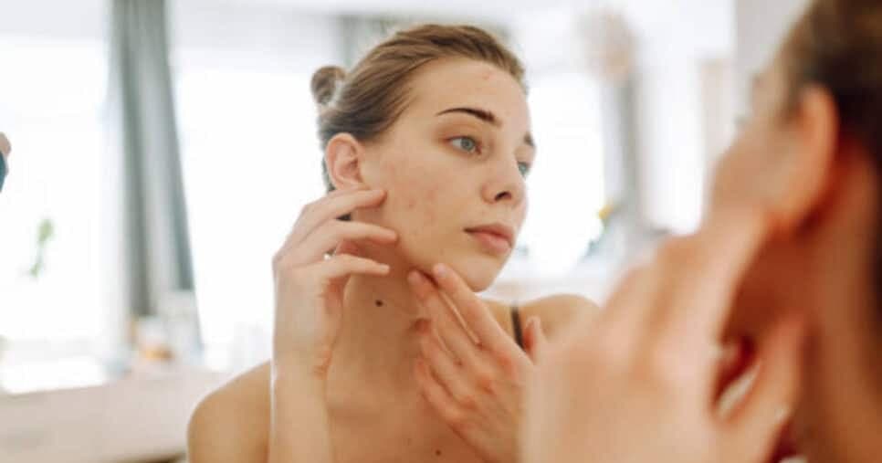 Óleo natural dá fim às manchas na pele e rejuvenesce idosos 60+
