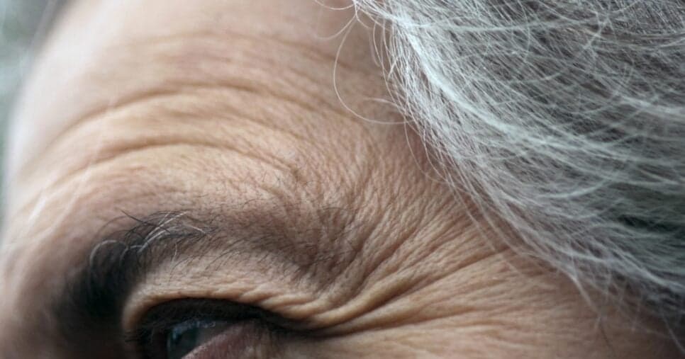 Mulheres de 40 com cara de 60: Alimento mais comum suga colágeno e traz 3x mais rugas