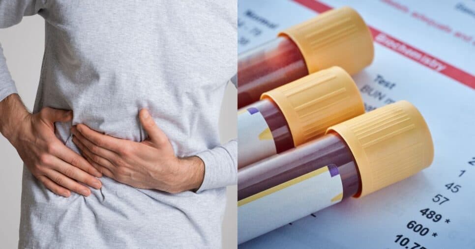 Dor na barriga e mais: 11 sinais silenciosos que indicam cirrose