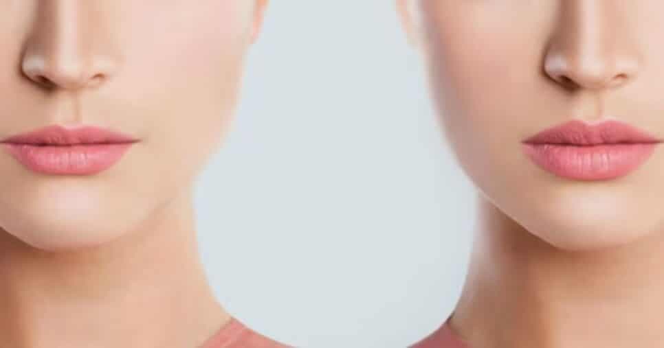 Preenchimento natural: Truque traz lábios volumosos e boca impecável instantaneamente