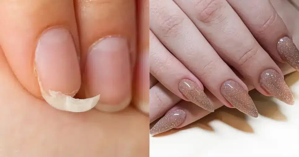 Esses hábitos podem deixar suas unhas fracas e amareladas