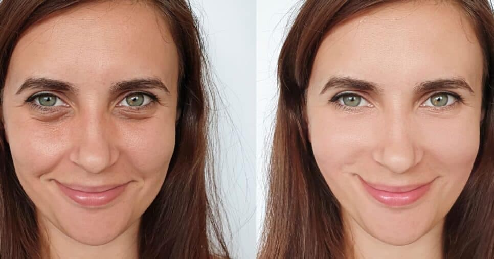 Óleo natural traz hidratação potente e rejuvenesce a pele