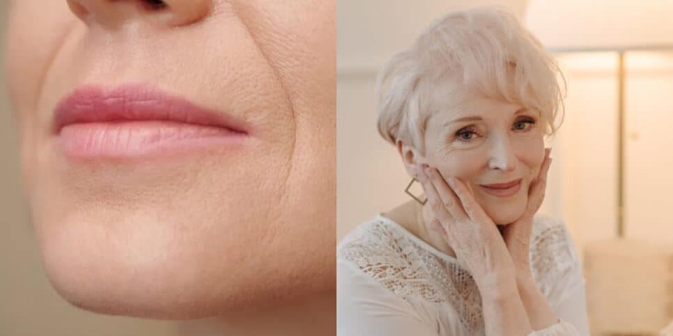 Senhoras com rostinho de 30: Método natural acaba com o bigode chinês