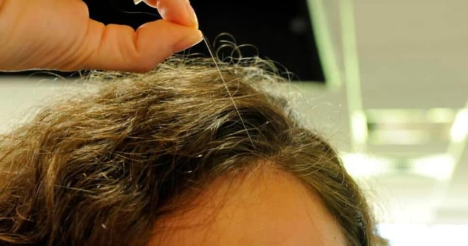 Brasileiros descobrem ingrediente que reverte o cabelo branco de vez