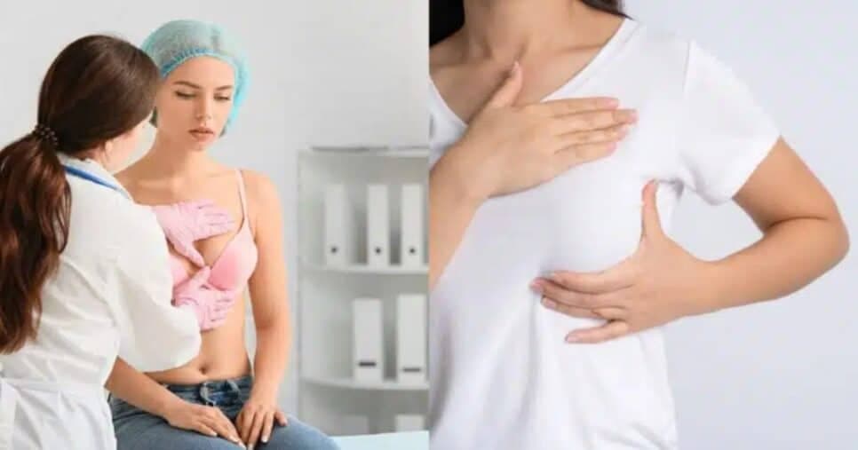 Sou ginecologista e aconselho: 5 dicas para fugir do câncer de mama