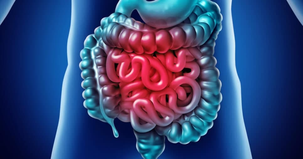 Melhor que laxante: 4 passos para fim do intestino preso sem gastar