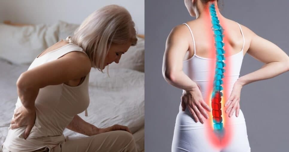 Ortopedista revela se osteoporose vira câncer e sinais de risco