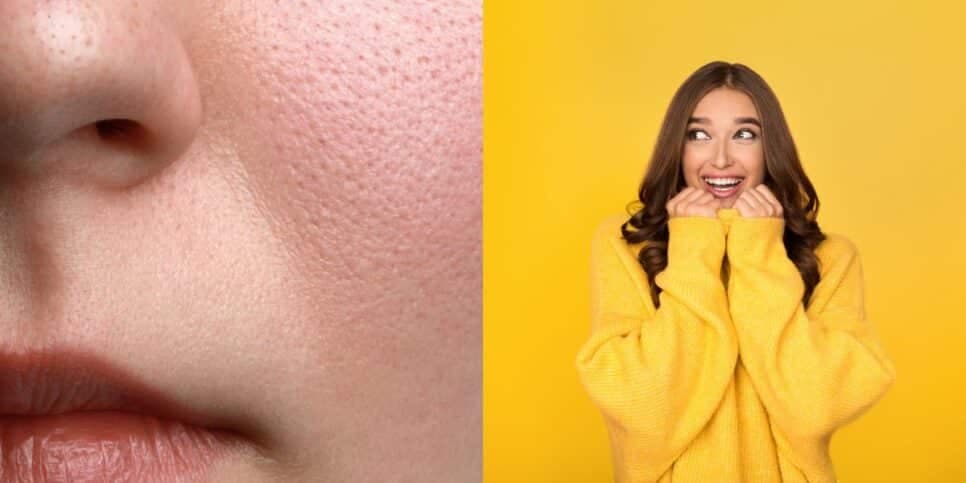 Pele lisa e jovem sem cremes: Técnica natural reduz poros dilatados em uma semana