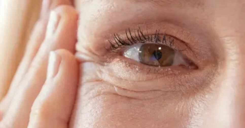 Melhor que botox: Mistura caseira elimina as rugas e turbina seu colágeno com 1 ingrediente
