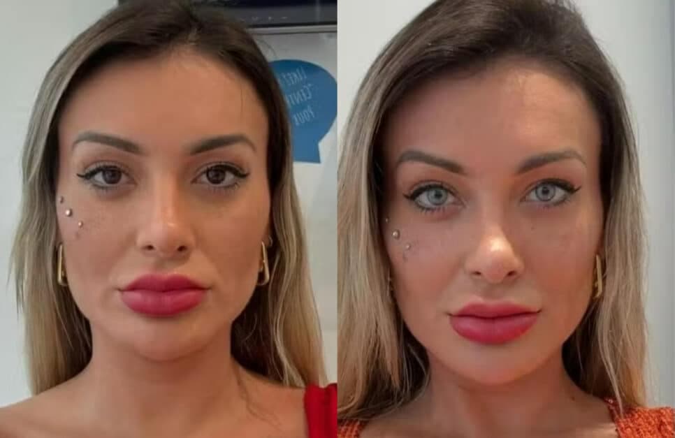 Andressa Urach fala sobe procedimento arriscado (Foto: Reprodução/Montagem)