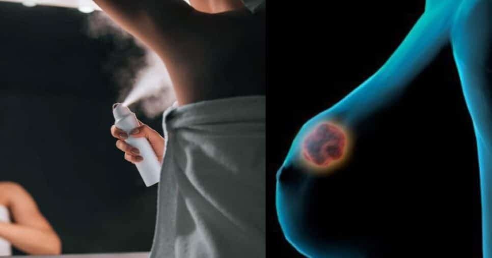 Desodorante causa câncer de mama? Médico explica se pode prejudicar a saúde