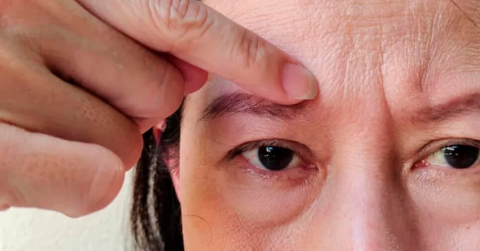 Pele de 25 aos 50 anos? Mistura está acabando rugas e devolvendo juventude da pele