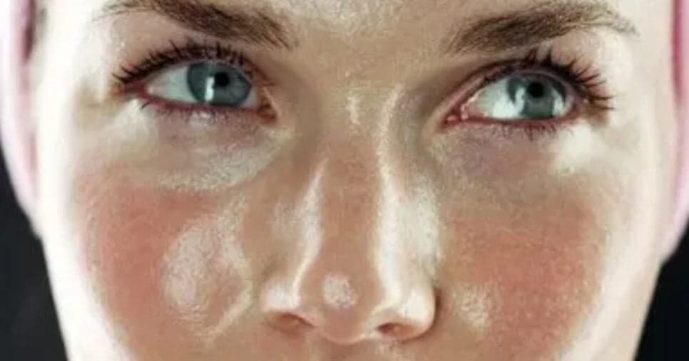 3 produtos populares, incluindo n°1 da Nivea, que você deve banir se tiver pele oleosa