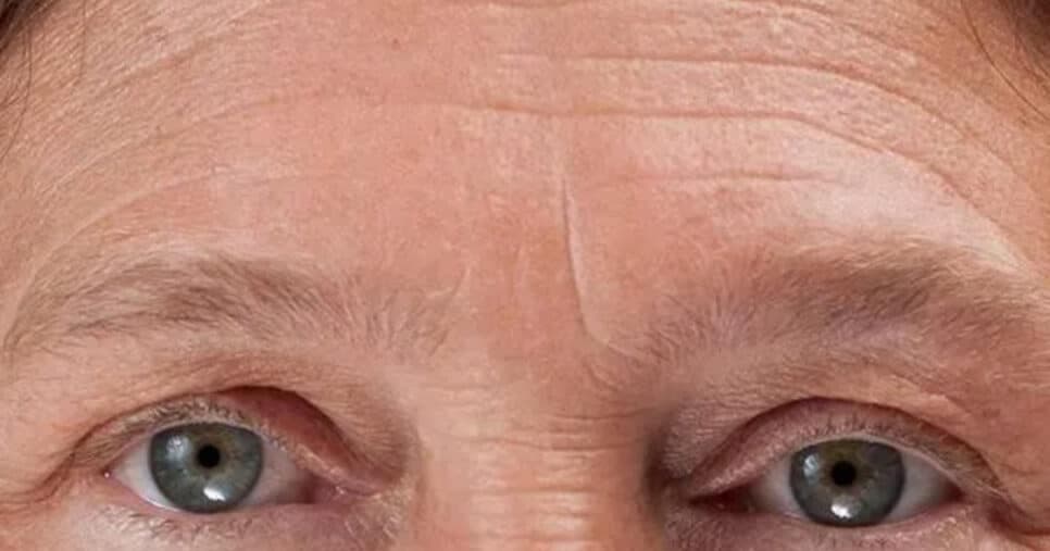 Envelhece 20 anos: 5 vilões que causam as rugas e envelhecem qualquer um