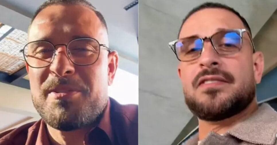 Diogo Nogueira fez harmonização facial? Cantor se pronuncia sobre mudança