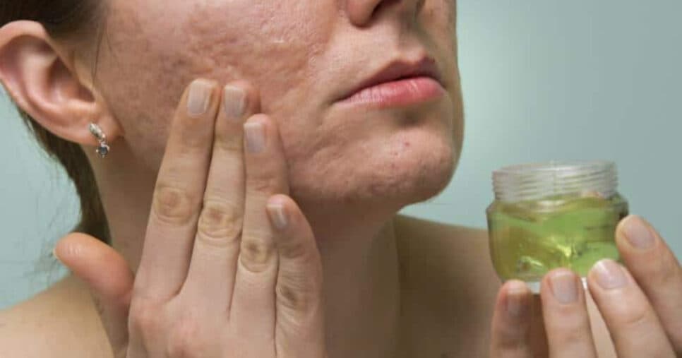 Receita antirrugas custa apenas R$ 7 e vai te livrar de rugas e manchas da idade