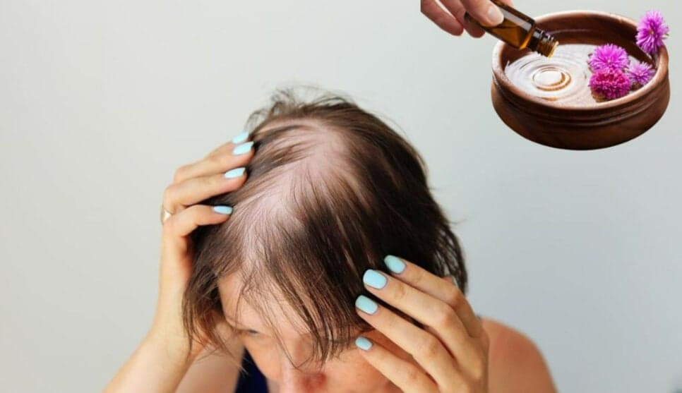 Fim da calvície: 3 óleos naturais para preencher falhas e fazer o cabelo crescer