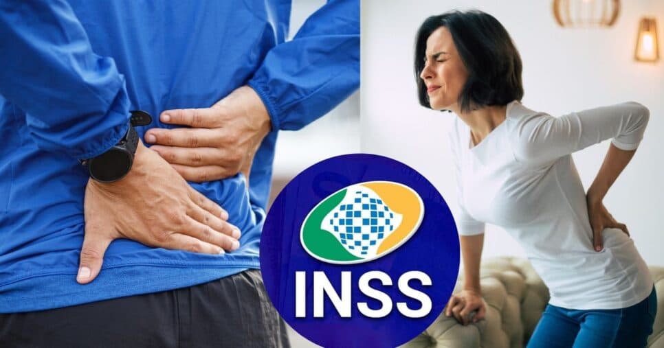Doença de coluna dá direito de se aposentar? Saiba como funciona esse tipo de benefício do INSS