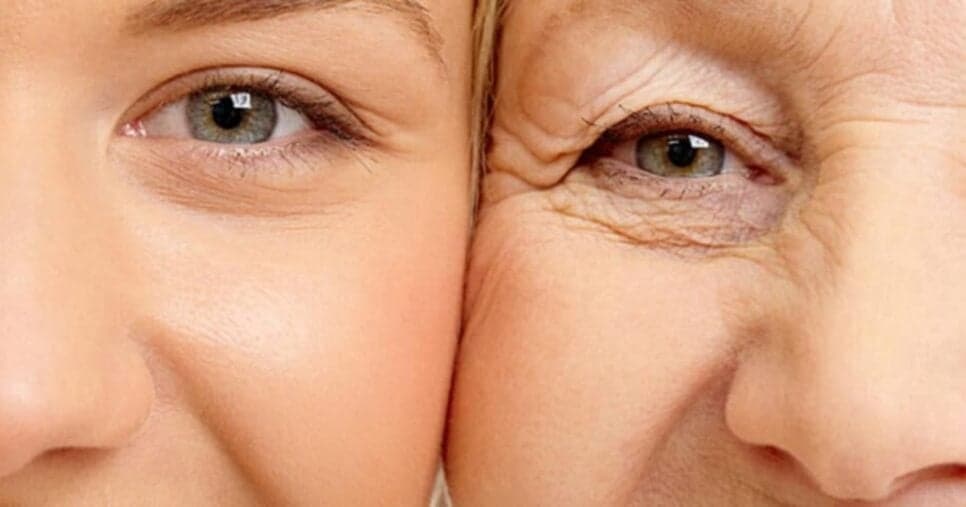 Melhor que botox: Máscara natural com 2 ingredientes esconde rugas e rejuvenesce rosto das 55+