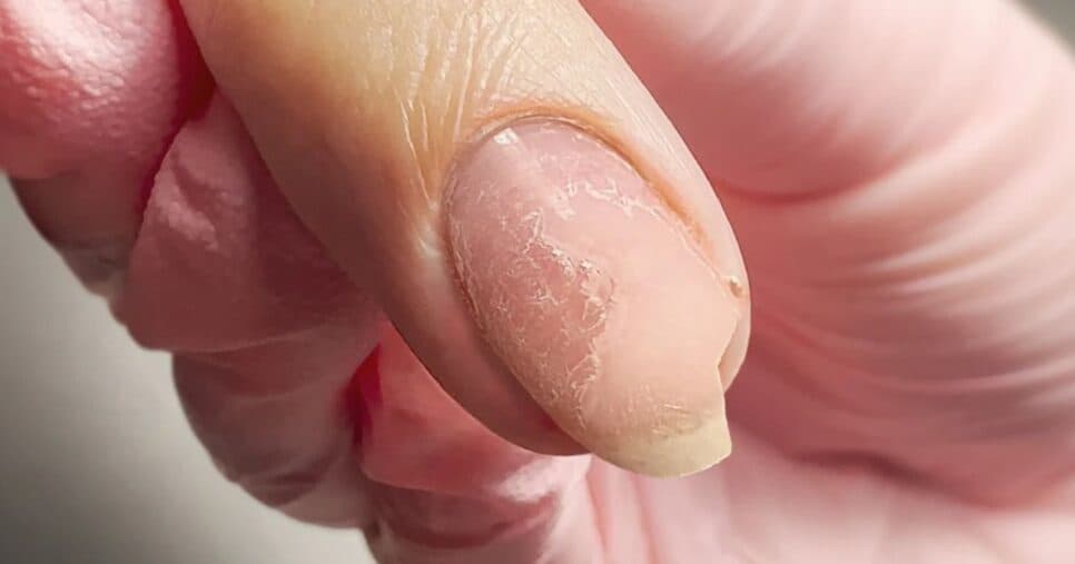 Unhas - Foto: Internet
