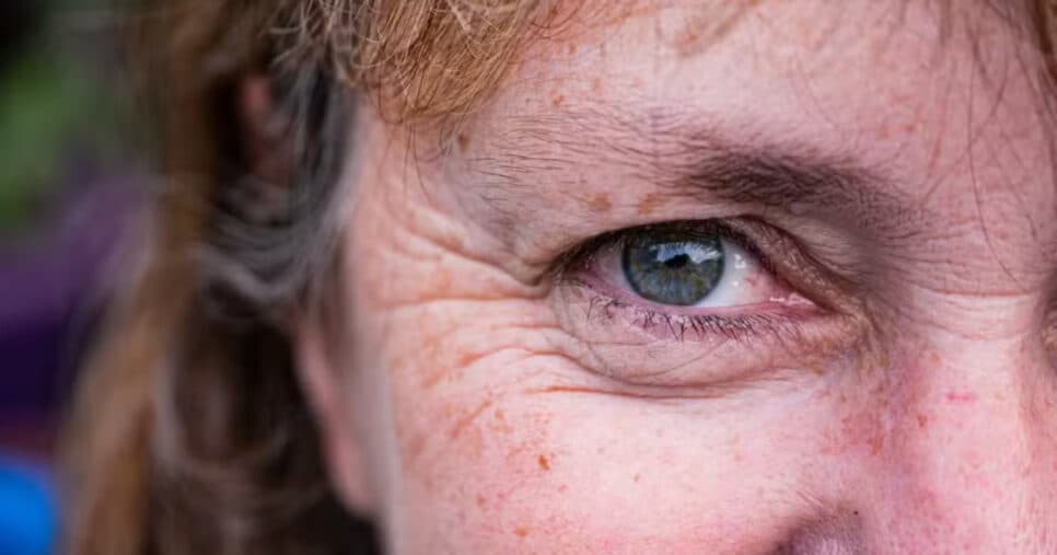 Segredo da juventude: Os 5 truques infalíveis para amenizar as rugas de qualquer mulher