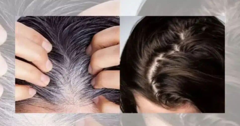 Salões escondem: Mistura natural com 1 ingrediente dá fim ao cabelo branco sem tinta e salva fios secos