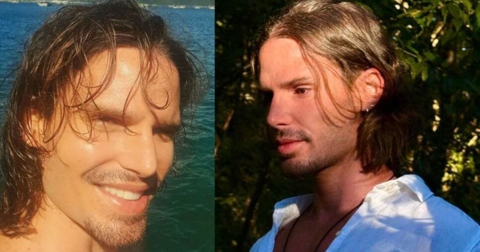 Jonatas Faro fez procedimento de harmonização facial (Foto Reprodução/Instagram @jonatasfaro)