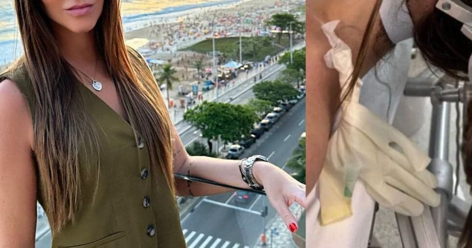 Imagens fortes expõem famosa em maca durante cirurgia para tirar tumor da cabeça: “Medo”
