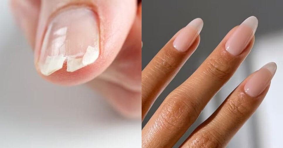 Nem a manicure te conta: Solução caseira com cravo alonga e fortalece a unhas de maneira instantânea
