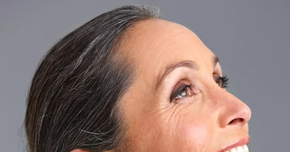 Só 3 ingredientes: Receita secreta combate as rugas de quem já passou dos 50 anos