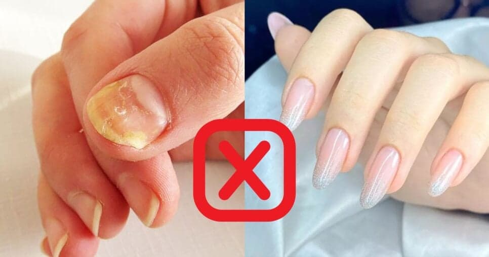 Fim do aspecto amarelo e quebras: Truque caseiro devolve o brilho e deixa unhas gigantes