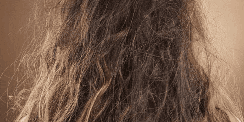 Cabelo com nó, frizz e pontas duplas (Foto: Reprodução/Internet)