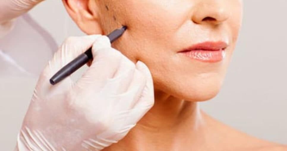 Bomba de colágeno: Lifting facial caseiro traz efeito às idosas em 5 minutos