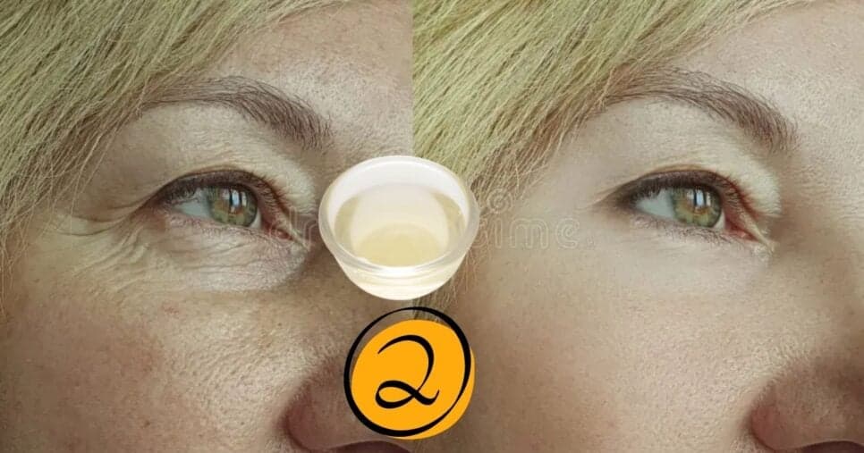 Fim do envelhecimento: Creme natural dispara colágeno e reduz rugas