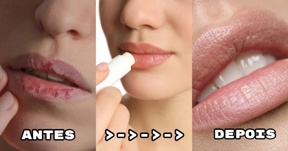 Para acabar com lábios rachados: 6 dicas infalíveis para acabar com pesadelo
