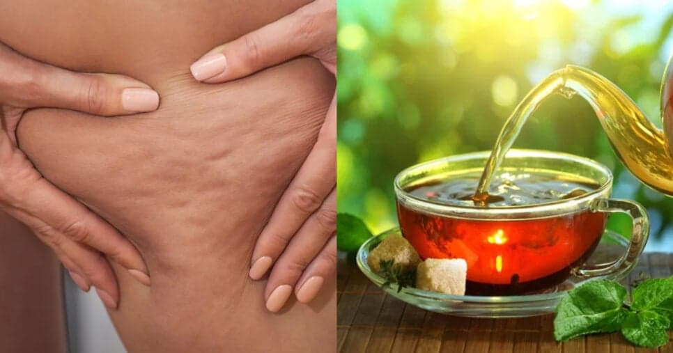 Adeus à celulite e furinhos na perna: Chá com ingrediente popular ameniza pesadelo
