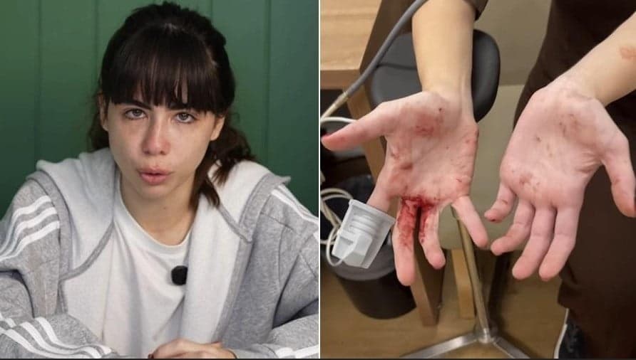 Atriz de Coração Acelerado foi assaltada (Foto: Reprodução / Instagram)

