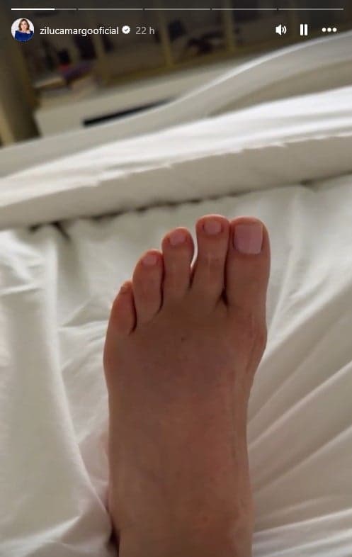 Famosa compartilhou processo de recuperação com os seguidores (Foto: Reprodução / Instagram)

