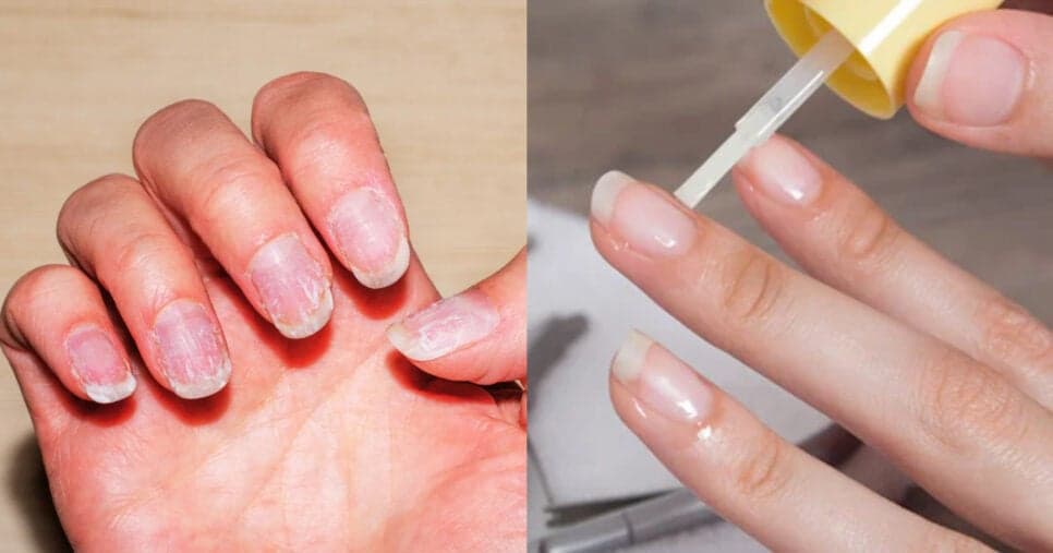 Guia completo para deixar as unhas grandes, fortes e lindas sem precisar gastar no salão