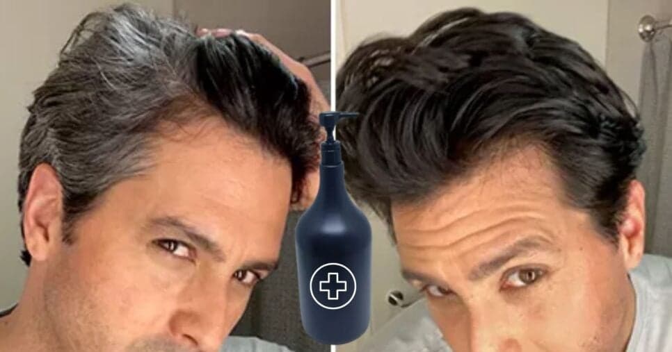 Cabeleireiras escondem até das amigas: Shampoo caseiro baratinho da farmácia cobre fios e dá fim a tinta