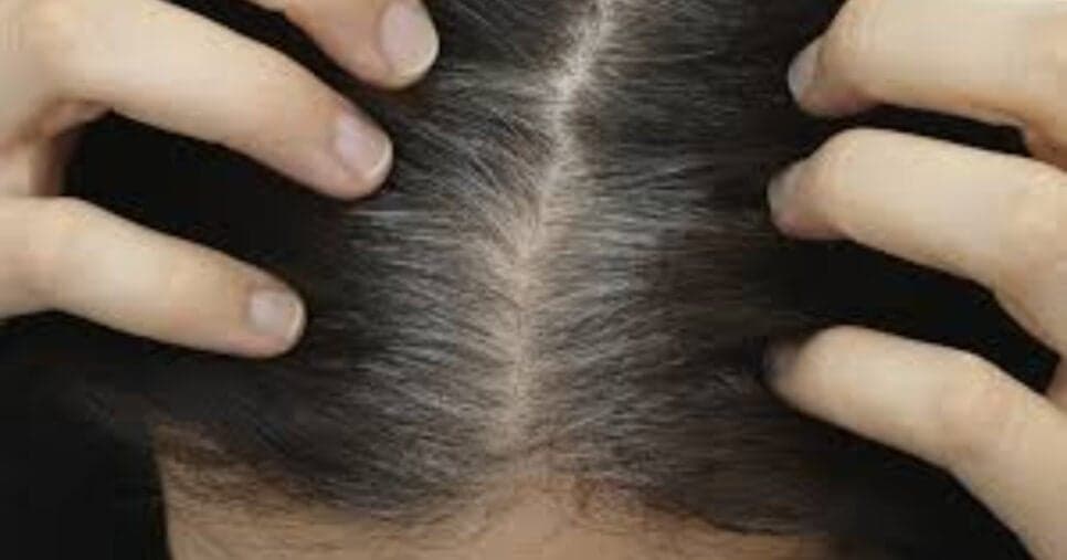 Saiba o que fazer para cobrir seus cabelos brancos em casa (Foto: Divulga&ccedil;&atilde;o)