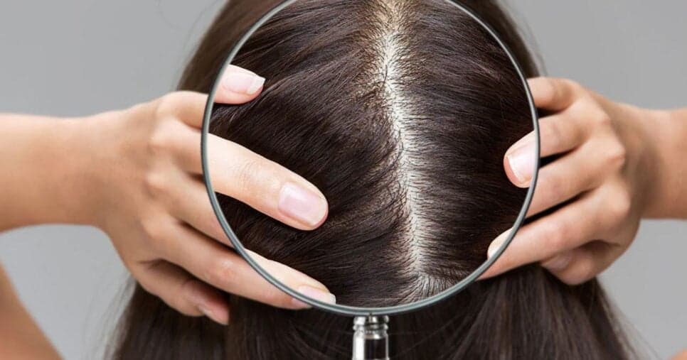 Como fazer esfoliação do couro cabeludo em casa para dar volume ao cabelo e fim a queda capilar