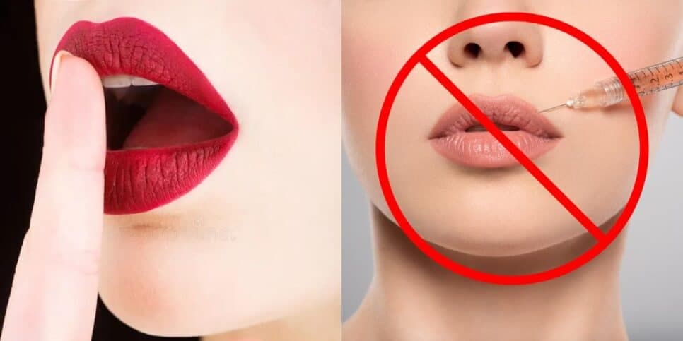 Melhor que preenchimento labial: Receita caseira com 1 ingrediente deixa lábios carnudos