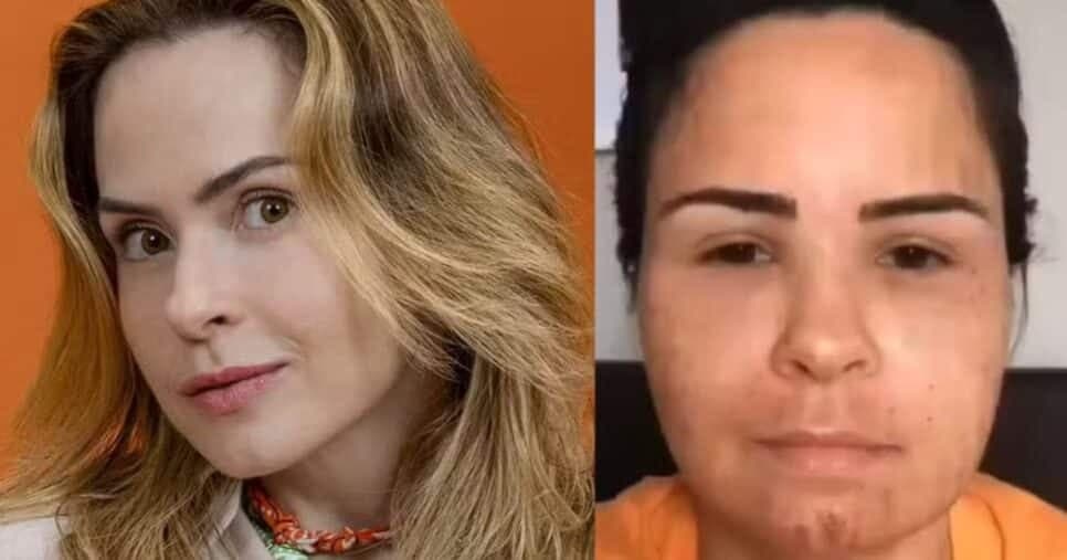 30kg mais magra e morena: Ana Paula Renault surge irreconhecível em foto antes do BBB26