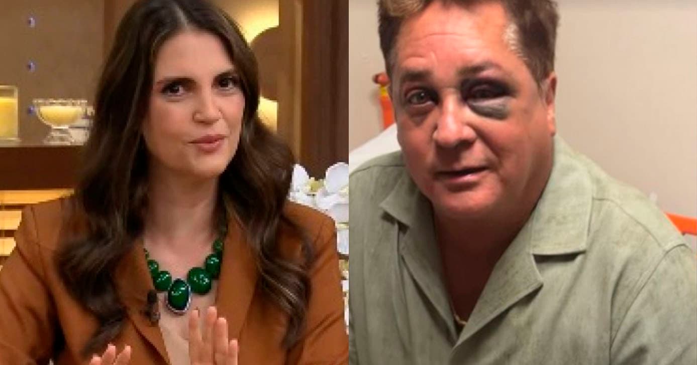 Chris Flores revela acidente de Leonardo e choca ao exibir hematomas: "O que aconteceu com esse homem?"