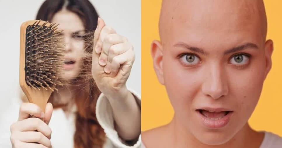 Queda de cabelo: 3 hábitos que vão te deixar careca se não cuidar