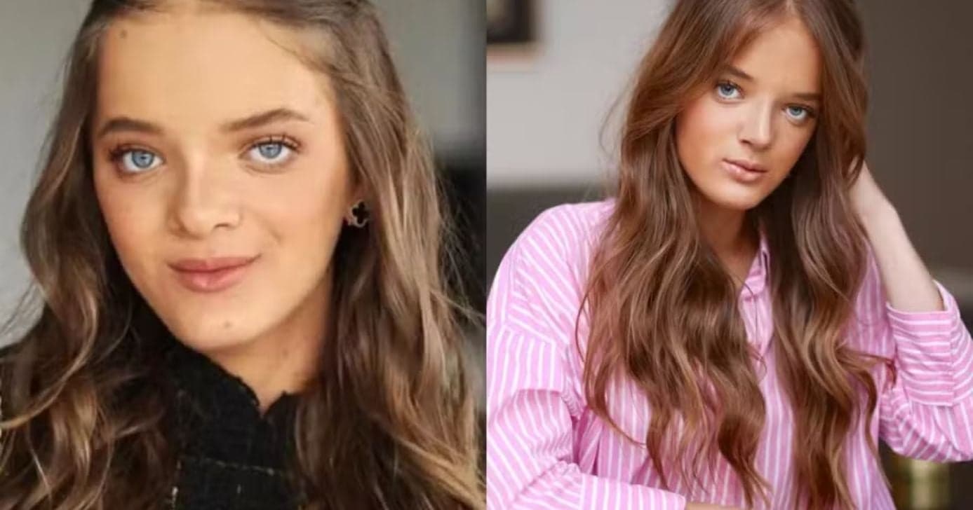 Rafinha Justus passa por novo procedimento no rosto, revela motivo e fotos exibem resultado: "Maravilhosa"