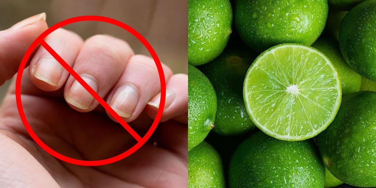 Fim das unhas amarelas: Como fazer solução com limão para clarear mãos e evitar quebras