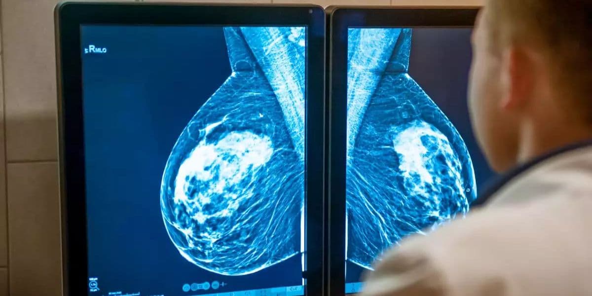 Mamografia é fundamental na prevenção do câncer de mama (Reprodução: Divulgação)