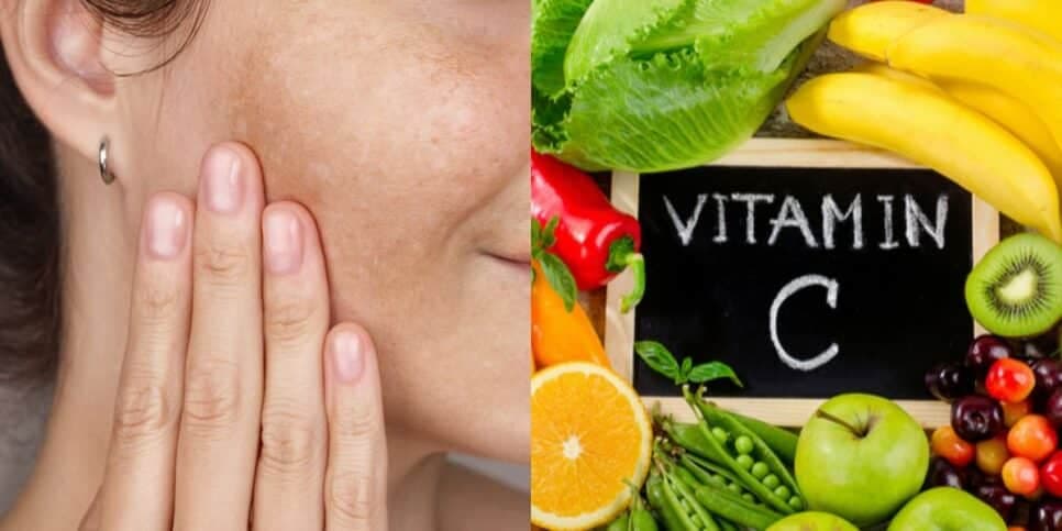 3 cremes com vitamina C que apagam manchas e devolvem o viço da pele